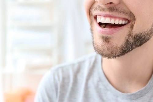 Human, Person, Face, Smile, Man, Mouth, Teeth, Laughing, Dentist